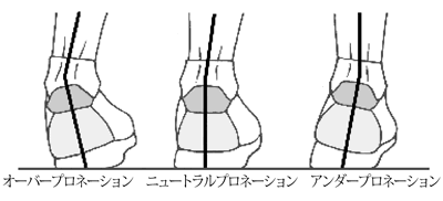 サピネーション　【 supination 】