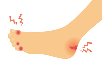 【初心者】足のマメ対策